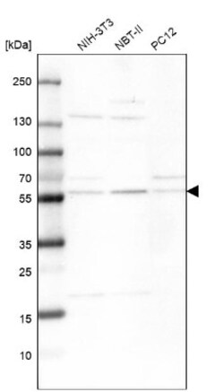 XPNPEP3 Antibody, Novus Biologicals:Antibodies:Primary Antibodies